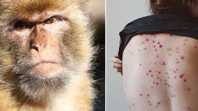 ماذا يحدث في الدوحة بعد انتشار جدري القرود؟