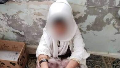 اليمن.. والد يعذب طفلته ويبيعها جارية