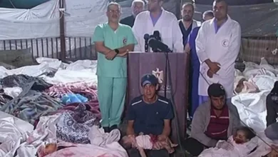 عمليات جراحية دون تخدير ومؤتمر صحفي وسط الجثث