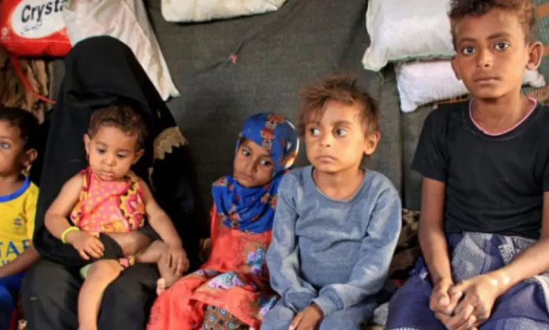 بسبب الحرب الحوثية والتحالف مع الإخوان.. الأوبئة تتفشى في أجساد اليمنيين