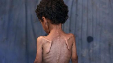 الأولوية للنجاة.. لا مكان لحرب المصطلحات في غزة الجائعة