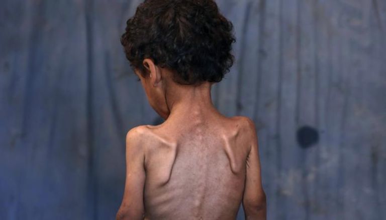 الأولوية للنجاة.. لا مكان لحرب المصطلحات في غزة الجائعة