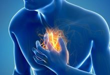 الحمى الروماتيزمية: مرض يمكن الوقاية منه لكنه يهدد القلب مدى الحياة