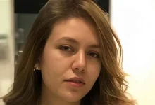 خطأ طبي يدمر نفسية ممثلة مصرية ويصيبها بالصلع!