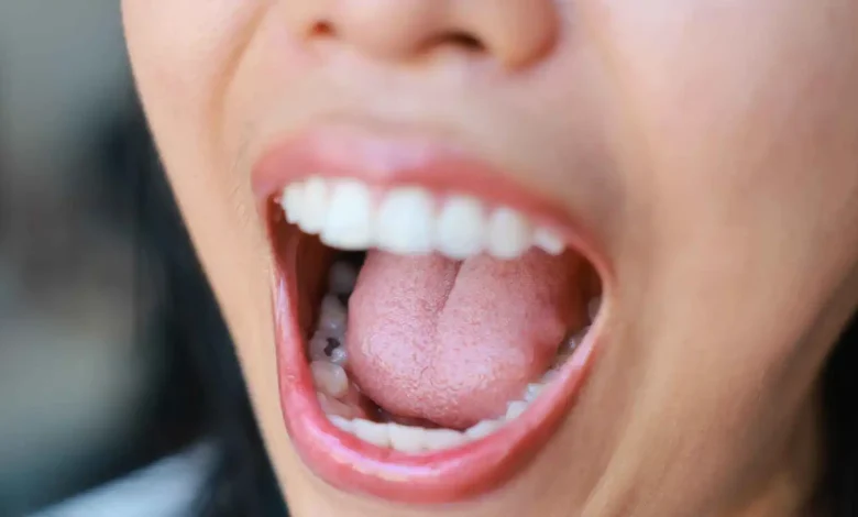 تصلب الشرايين والنوبات القلبية قد تبدأ من الفم