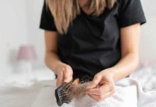 باحثون يعثرون على طريقة فعالة لتحفيز إعادة نمو الشعر بعد الصلع