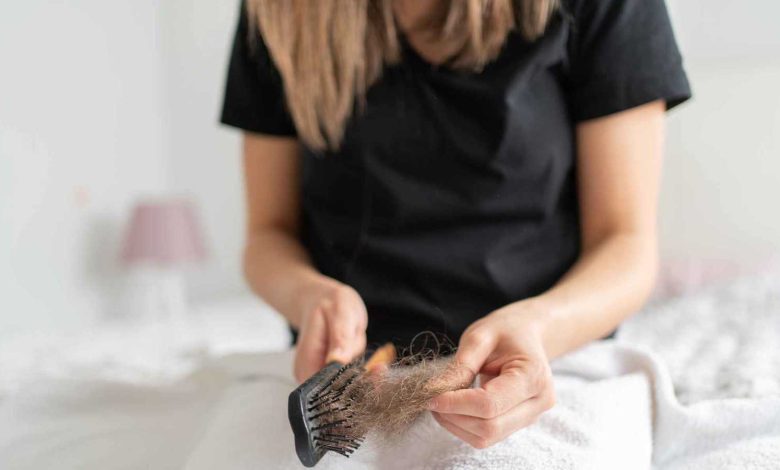 باحثون يعثرون على طريقة فعالة لتحفيز إعادة نمو الشعر بعد الصلع