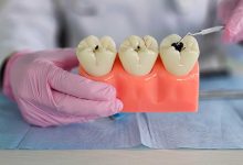 معجون أسنان مبتكر يستخدم بروتين الشعر لتقوية الأسنان ومكافحة التسوس