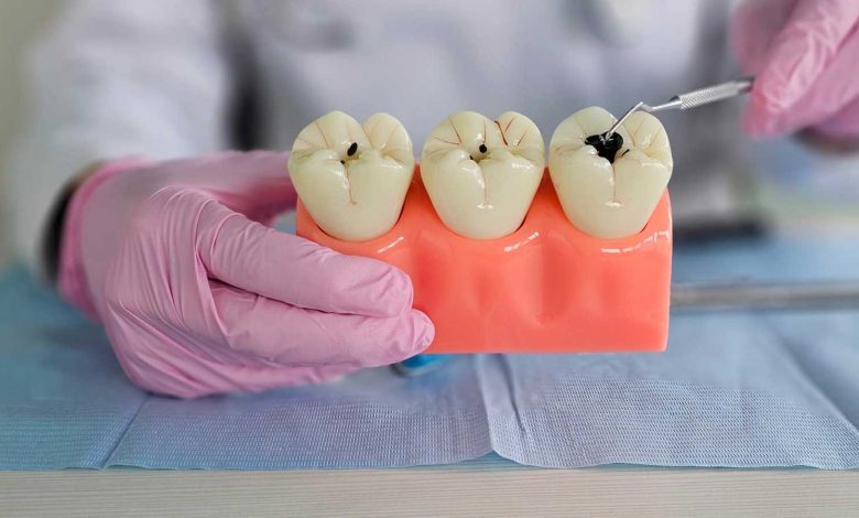 معجون أسنان مبتكر يستخدم بروتين الشعر لتقوية الأسنان ومكافحة التسوس