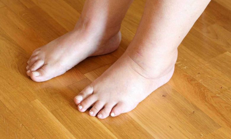 هل وزنك ارتفع فجأة؟ إليك كيف تميز بين الدهون والماء المحتبس