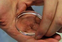 179 طفلاً في خطر: طفرة جينية نادرة تنتقل عبر التبرع بالحيوانات المنوية