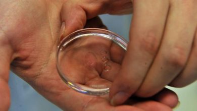 179 طفلاً في خطر: طفرة جينية نادرة تنتقل عبر التبرع بالحيوانات المنوية