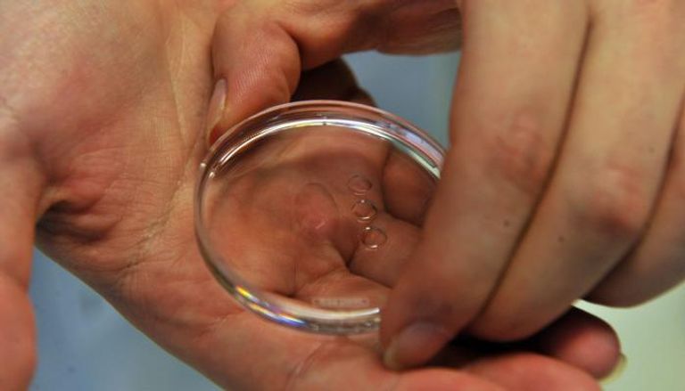 179 طفلاً في خطر: طفرة جينية نادرة تنتقل عبر التبرع بالحيوانات المنوية