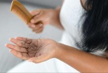 تساقط الشعر لدى النساء.. الأسباب الشائعة والحلول المتاحة