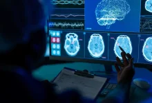 ابتكار مغناطيسي واعد يساهم في خفض مخاطر السكتة الدماغية