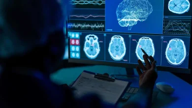 ابتكار مغناطيسي واعد يساهم في خفض مخاطر السكتة الدماغية