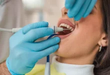 نزيف اللثة قد يكشف مؤشراً مبكراً لسرطان الأمعاء