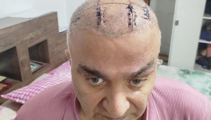 إيران: شهادات سجناء سابقين تثير جدلاً حول أوضاع الاحتجاز