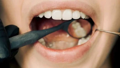 ما العلاقة بين صحة الفم والتهاب مفاصل اليد؟ دراسة تجيب